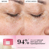 Vitamin C Brightening Korean Guava Toner Pads for Undereye & Cheeks