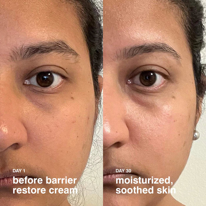 Barrier Restore Cream Comforting Daily Moisturizer