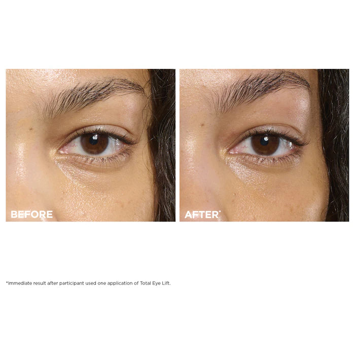 Anti Aging Skincare Essentials Set