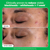 Complexion Clarity Duo with Salicylic Acid & Azelaic Acid