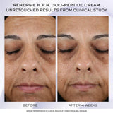 Rénergie H.C.F. Triple Serum Skincare Discovery Set