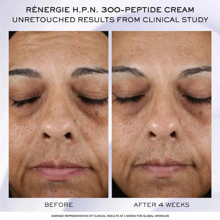 Rénergie H.C.F. Triple Serum Skincare Discovery Set