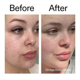 Daily Fresh Skin Fix Set