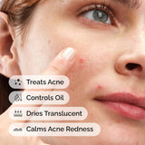 Sulfur 10% Powder-to-Cream Concentrate Acne Spot Treatment