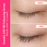 Lash & Brow Luxuries - Serum and Mascara Set