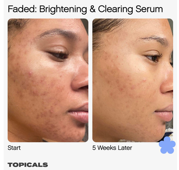 Faded Serum for Dark Spots & Discoloration