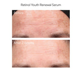 Youth Renewal Retinol Trial Kit for Smoother, Younger-Looking Skin